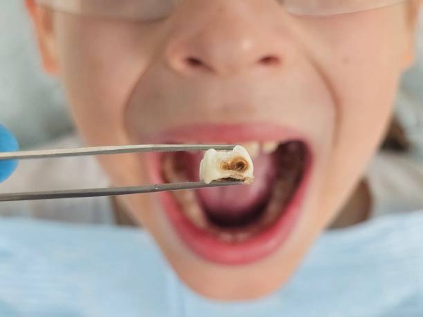 Best Emergency Pediatric Dental Care in Bishopville, SC